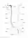 Fig. 14 - Systems and methods for removing obstructive matter from body lumens and treating vascular defects