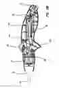 Fig. 11 - Single port instruments