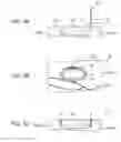 Fig. 06 - CELLULAR TISSUE DISSECTION METHOD