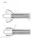 Fig. 02 - Shock wave focusing device, shock wave generation apparatus, and shock wave ablation system