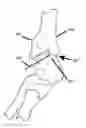 Fig. 01 - ARTHROSCOPIC JOINT SURGERY DEVICE AND METHOD OF USE