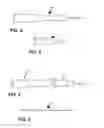Fig. 03 - ARTHROSCOPIC JOINT SURGERY DEVICE AND METHOD OF USE