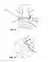 Fig. 05 - ARTHROSCOPIC JOINT SURGERY DEVICE AND METHOD OF USE