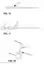 Fig. 08 - ARTHROSCOPIC JOINT SURGERY DEVICE AND METHOD OF USE