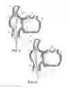 Fig. 04 - METHOD AND APPARATUS FOR ACCESSING THE LEFT ATRIAL APPENDAGE