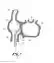 Fig. 05 - METHOD AND APPARATUS FOR ACCESSING THE LEFT ATRIAL APPENDAGE