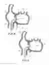 Fig. 06 - METHOD AND APPARATUS FOR ACCESSING THE LEFT ATRIAL APPENDAGE