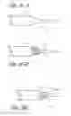 Fig. 11 - METHOD AND APPARATUS FOR ACCESSING THE LEFT ATRIAL APPENDAGE