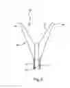 Fig. 03 - Therapeutic substance transfer catheter and method