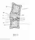 Fig. 06 - Apparatus for promoting movement of nutrients to intervertebral space and method of use