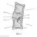 Fig. 07 - Apparatus for promoting movement of nutrients to intervertebral space and method of use