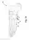 Fig. 22 - Compression screw systems for compressing bones of the extremities