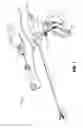 Fig. 02 - Modular surgical instrument with contained electrical or mechanical systems