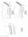 Fig. 04 - HYBRID CATHETER APPARATUS AND METHODS