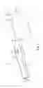 Fig. 04 - Surgical tool adapted for identifying an incision site