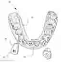 Fig. 01 - METHOD FOR PRODUCING AN ORTHODONTIC SETUP