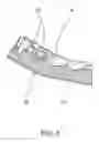 Fig. 06 - METHOD FOR PRODUCING AN ORTHODONTIC SETUP