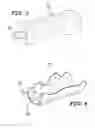 Fig. 03 - Orthodontic indirect bonding tray including stabilization features