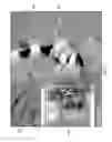 Fig. 03 - Unified three dimensional virtual craniofacial and dentition model and uses thereof