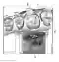 Fig. 08 - Unified three dimensional virtual craniofacial and dentition model and uses thereof