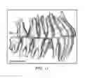 Fig. 12 - Unified three dimensional virtual craniofacial and dentition model and uses thereof