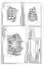 Fig. 13 - Unified three dimensional virtual craniofacial and dentition model and uses thereof