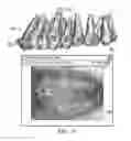 Fig. 15 - Unified three dimensional virtual craniofacial and dentition model and uses thereof