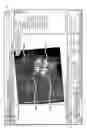 Fig. 24 - Unified three dimensional virtual craniofacial and dentition model and uses thereof