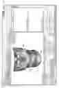 Fig. 25 - Unified three dimensional virtual craniofacial and dentition model and uses thereof
