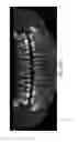 Fig. 45 - Unified three dimensional virtual craniofacial and dentition model and uses thereof