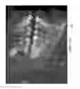 Fig. 46 - Unified three dimensional virtual craniofacial and dentition model and uses thereof
