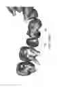 Fig. 49 - Unified three dimensional virtual craniofacial and dentition model and uses thereof