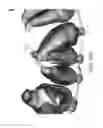 Fig. 50 - Unified three dimensional virtual craniofacial and dentition model and uses thereof