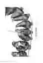 Fig. 52 - Unified three dimensional virtual craniofacial and dentition model and uses thereof