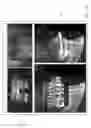 Fig. 55 - Unified three dimensional virtual craniofacial and dentition model and uses thereof