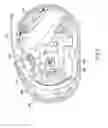 Fig. 04 - Fluid delivery device