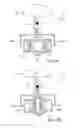 Fig. 14 - Method for controlling flow of intestinal contents in a patient's intestines