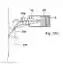 Fig. 16 - Method for controlling flow of intestinal contents in a patient's intestines