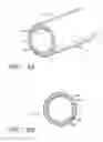 Fig. 04 - Extracellular matrix constructs for treating damaged biological tissue