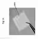 Fig. 02 - Method for use of a double-structured tissue implant for treatment of tissue defects