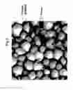 Fig. 04 - Method for use of a double-structured tissue implant for treatment of tissue defects