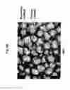 Fig. 07 - Method for use of a double-structured tissue implant for treatment of tissue defects