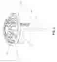 Fig. 03 - System and Method for Heart Valve Anchoring