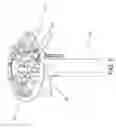 Fig. 06 - System and Method for Heart Valve Anchoring