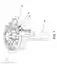Fig. 08 - System and Method for Heart Valve Anchoring