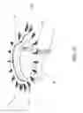 Fig. 11 - System and Method for Heart Valve Anchoring