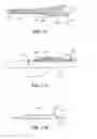 Fig. 17 - Systems and methods for endoluminal valve creation