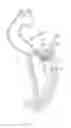 Fig. 08 - Prosthetic valve with vortice-inducing baffle