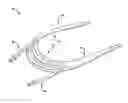Fig. 01 - Device, system, and method for treating a regurgitant heart valve
