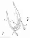 Fig. 03 - Device, system, and method for treating a regurgitant heart valve